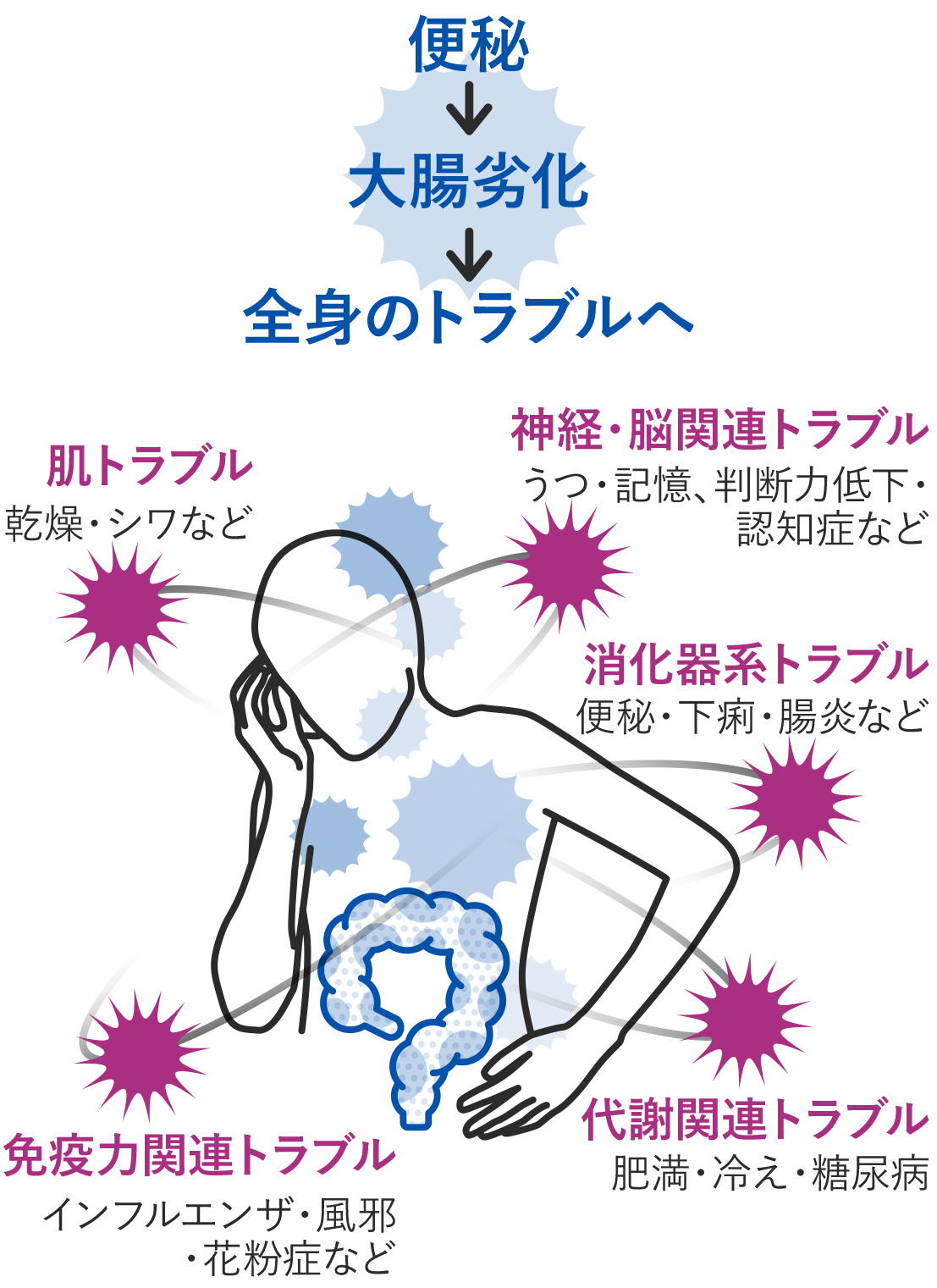 便秘 原因 ストレス